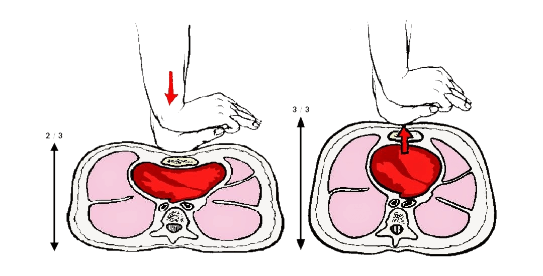 CPR nedir, kalp masajı nedir, CPR nasıl yapılır