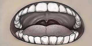 diş barotravması nedir, diş barotravması, diş barotravmasının sebepleri nelerdir